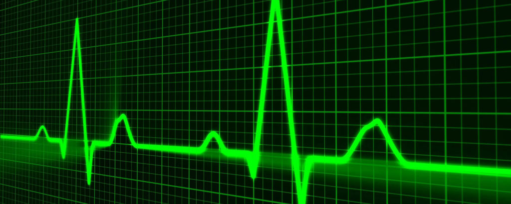 Green line showing heartbeat on an electronic pulse monitor or ECG display.